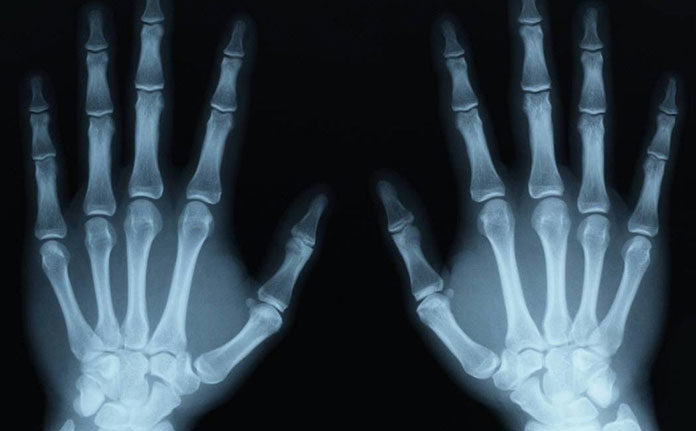 W jakich przypadkach warto wykupić rentgen?