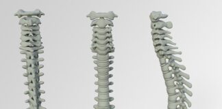 Jak naprawić wypadanie zapłonu?